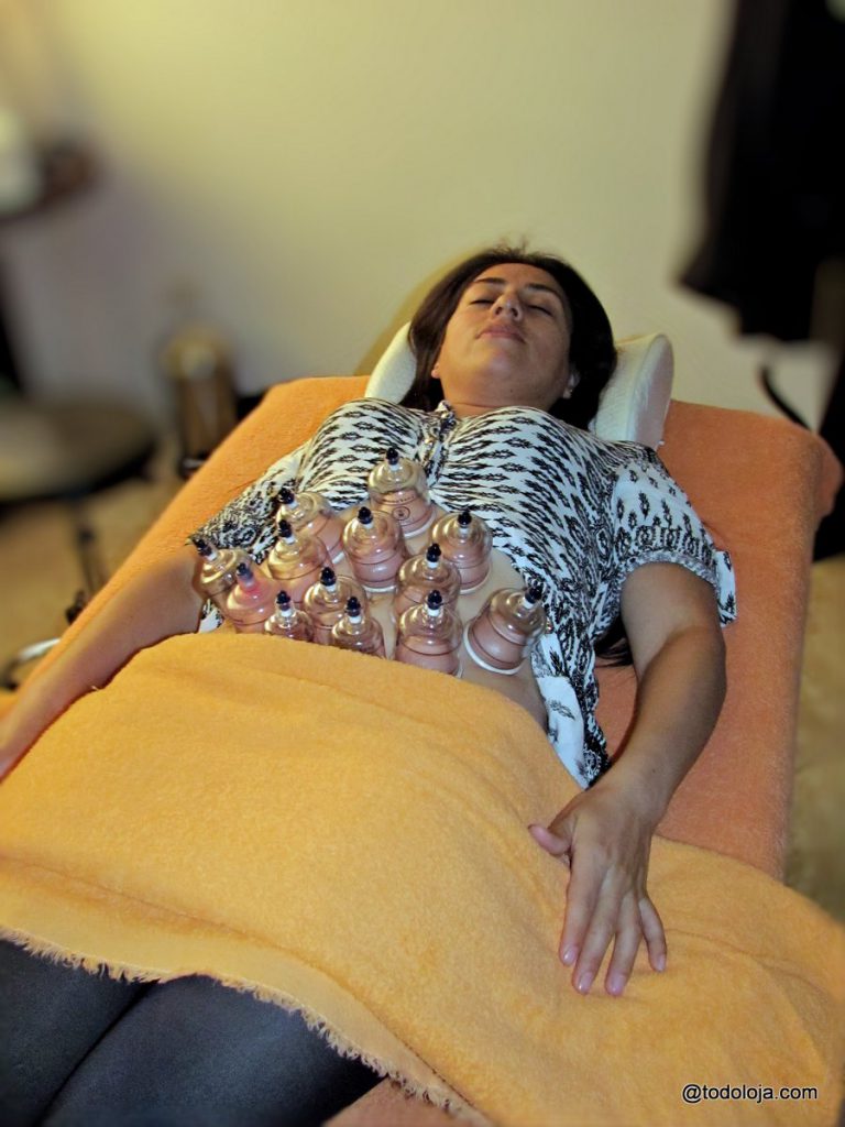 QI Esencial Loja - Cupping Therapy